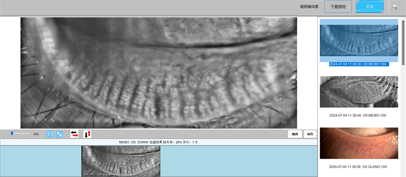 /Files/Image/20240705/%e7%9d%91%e6%9d%bf%e8%85%ba%e6%a3%80%e6%9f%a5.png?2024071510215125